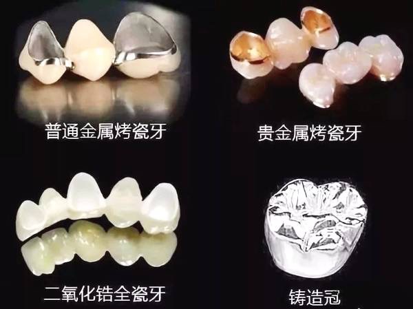 常德美奧口腔鉅惠看牙,韓國登騰種植牙3980元起,自鎖托槽矯正享5折優(yōu)惠！