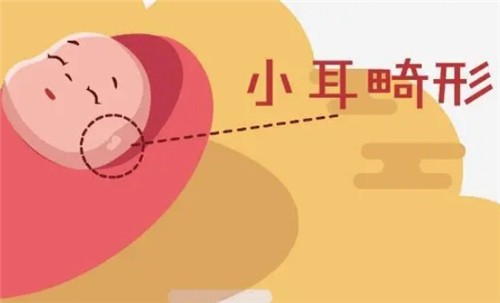 【河南中醫(yī)藥大學一附院】莊洪興教授暑假坐診，耳畸形修復限時預約！