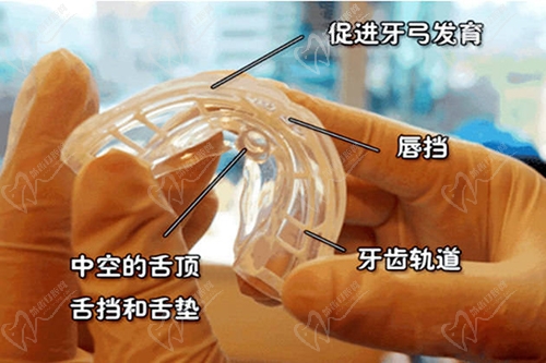 矯治器