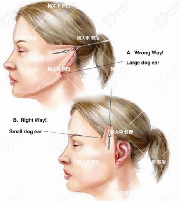 2024北京聯(lián)合麗格醫(yī)院面部提升收費標準