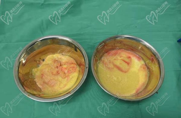 國(guó)內(nèi)異物取出醫(yī)生排名前十名