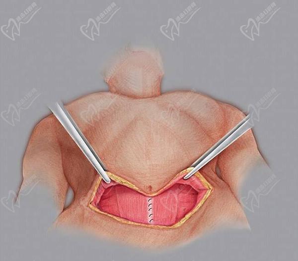 安洪賓醫(yī)生真實(shí)實(shí)例
