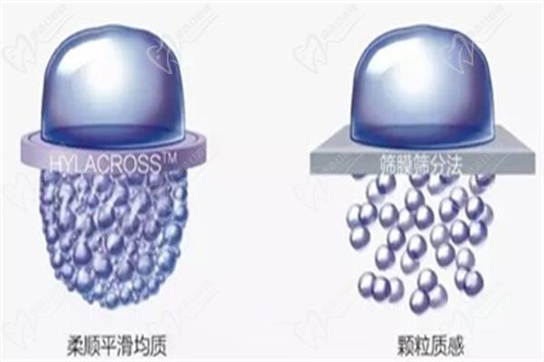 少女注射價(jià)格