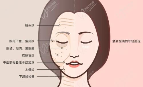 安洪賓網(wǎng)兜提升怎么樣