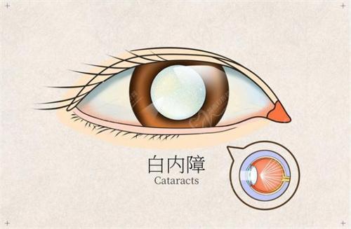 簡陽市人民 醫(yī)院眼科蔡方榮擅長項目