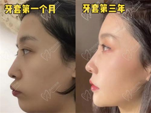 四、如何預(yù)約拜博口腔醫(yī)院牙齒矯正？