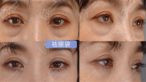 四、南京美萊王小林醫(yī)生正規(guī)嗎? 四、南京美萊王小林醫(yī)生正規(guī)嗎?