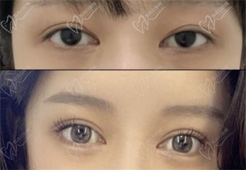 五、南京美萊王小林醫(yī)生患者評(píng)價(jià)與反饋 五、南京美萊王小林醫(yī)生患者評(píng)價(jià)與反饋