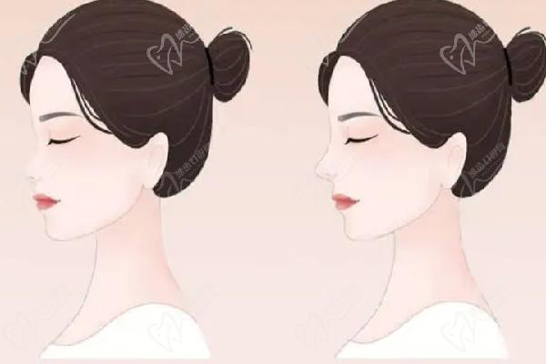 北京鼻整形宮鳳勇醫(yī)生坐診醫(yī)院