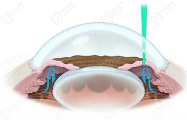 上海和平眼科醫(yī)院虹膜外科專家有誰-郭?？?吳志平好評(píng)看費(fèi)用多少